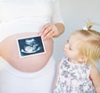 Smoking in Pregnancy 